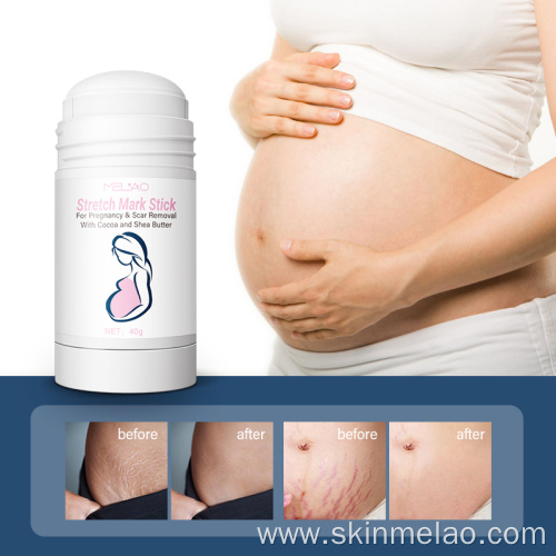 Pregnancy Removal Scars Prevention Stretch Cream Stick